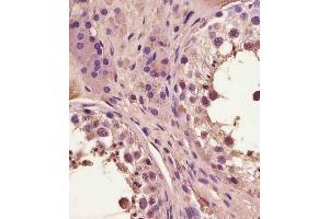 (ABIN6243665 and ABIN6578886) staining FA in human testis tissue sections by Immunohistochemistry (IHC-P - paraformaldehyde-fixed, paraffin-embedded sections). (FAM3A 抗体  (AA 201-230))