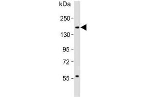 Western blot testing of human spleen lysate with CD11b antibody. (CD11b 抗体  (AA 253-282))