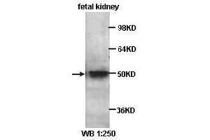 Western Blotting (WB) image for anti-Kruppel-Like Factor 8 (KLF8) antibody (ABIN1856579) (KLF8 抗体)