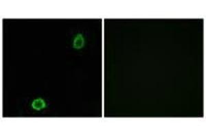 Immunofluorescence analysis of A549 cells, using ABCA13 antibody.