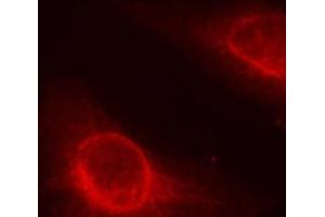 Immunofluorescence analysis of methanol-fixed HeLa cells using Phospho-CFL1(S3) Polyclonal Antibody (Cofilin 抗体  (pSer3))