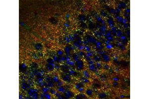 Immunohistochemistry (IHC) image for anti-Tumor Protein P63 Regulated 1-Like (TPRG1L) antibody (ABIN1742502) (TPRG1L 抗体)