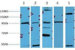 Western Blotting (WB) image for anti-Catenin, beta (CATNB) antibody (ABIN3178618) (beta Catenin 抗体)