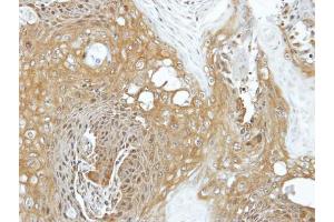 IHC-P Image Immunohistochemical analysis of paraffin-embedded Cal27 xenograft, using EIF3K, antibody at 1:100 dilution.