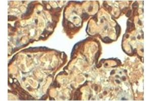 Image no. 3 for anti-Plasminogen Activator Inhibitor 1 (SERPINE1) (Internal Region) antibody (ABIN374547) (PAI1 抗体  (Internal Region))