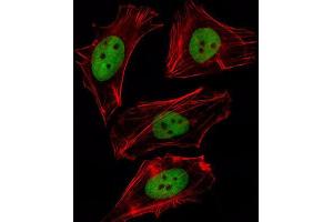 Immunofluorescence (IF) image for anti-Forkhead Box D1 (FOXD1) antibody (ABIN2997954) (FOXD1 抗体)