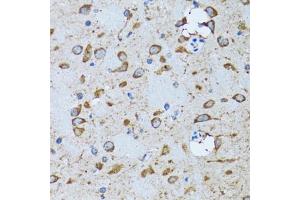 Immunohistochemistry of paraffin-embedded mouse brain using PDP1 antibody (ABIN6132860, ABIN6145404, ABIN6145405 and ABIN6221944) at dilution of 1:100 (40x lens). (PDP 抗体  (AA 278-537))