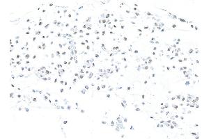 Immunocytochemistry (ICC) image for anti-Mismatch Repair Protein 2 (MSH2) (AA 625-675) antibody (ABIN7453978) (Recombinant MSH2 抗体  (AA 625-675))