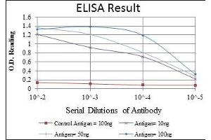 Red: Control Antigen (100 ng), Purple: Antigen (10 ng), Green: Antigen (50 ng), Blue: Antigen (100 ng), (CCT2 抗体)