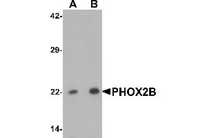 Western blot analysis of PHOX2B in 293 cell lysate with PHOX2B antibody at (A) 1 and (B) 2 µg/mL. (PHOX2B 抗体  (Middle Region))