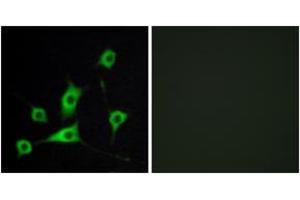 Immunofluorescence analysis of LOVO cells, using CRBP III Antibody. (Retinol Binding Protein 5 抗体  (AA 10-59))