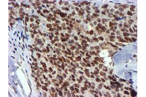 Image no. 10 for anti-Ubiquitin Specific Peptidase 7 (Herpes Virus-Associated) (USP7) antibody (ABIN1498592) (USP7 抗体)