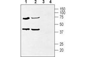 Western blot analysis of rat heart (lanes 1 and 3) and rat hippocampus (lanes 2 and 4) lysate: - 1,2. (KCNIP2 抗体  (Cytosolic, N-Term))