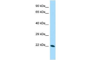 WB Suggested Anti-CDNF Antibody Titration: 1. (CDNF 抗体  (N-Term))