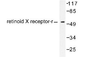 Image no. 1 for anti-Retinoid X Receptor, gamma (RXRG) antibody (ABIN271807) (Retinoid X Receptor gamma 抗体)