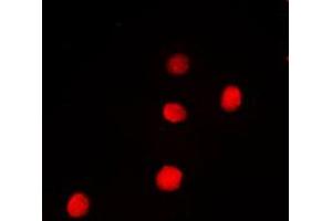 Immunofluorescent analysis of PAX9 staining in Jurkat cells. (PAX9 抗体  (Center))