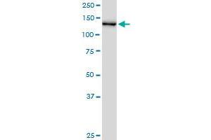 CHERP MaxPab polyclonal antibody. (CHERP 抗体  (AA 1-884))