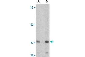 Western blot analysis of FBXL20 in A-20 cell lysate with FBXL20 polyclonal antibody  at (A) 0.