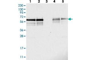 Western blot analysis of Lane 1: RT-4, Lane 2: U-251 MG, Lane 3: Human Plasma, Lane 4: Liver, Lane 5: Tonsil with BSDC1 polyclonal antibody  at 1:250-1:500 dilution. (BSDC1 抗体)