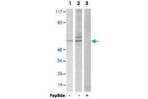 Western blot analysis of extracts from HepG2 cells (Lane 1 and 3) and 293 cells (Lane 2), using DAB1 polyclonal antibody .