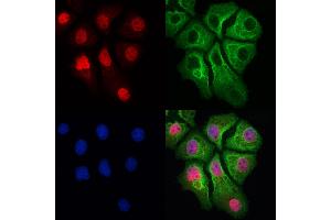 ABIN6265927 and ABIN6273024 staining Hela cells by IF/ICC. (USP39 抗体  (N-Term))