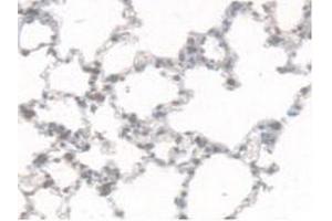 Immunohistochemistry (IHC) image for anti-Carboxylesterase 1 (CES1) (AA 19-300) antibody (ABIN7434857)