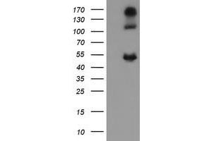 Image no. 2 for anti-Carbonic Anhydrase 12 (CA12) antibody (ABIN1497065) (CA12 抗体)
