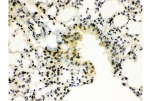 IHC testing of FFPE mouse lung wtih SP3 antibody. (Sp3 抗体)