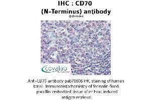 Image no. 1 for anti-CD70 Molecule (CD70) (N-Term) antibody (ABIN1732877) (CD70 抗体  (N-Term))