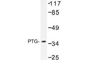 Image no. 1 for anti-Protein Phosphatase 1, Regulatory Subunit 3C (PPP1R3C) antibody (ABIN317934) (PPP1R3C 抗体)