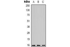 Western blot analysis of C/EBP gamma expression in Jurkat (A), Hela (B), RAW264. (CEBPG 抗体)