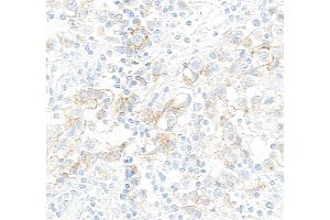 Immunohistochemistry (IHC) image for anti-Mast/stem Cell Growth Factor Receptor (KIT) (AA 325-375) antibody (ABIN7795658)