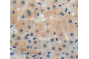 IHC-P analysis of liver tissue, with DAB staining. (CMTM8 抗体  (AA 1-173))
