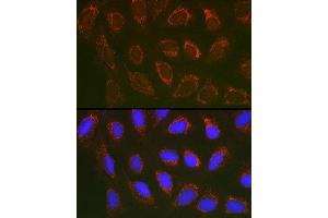 Immunofluorescence (IF) image for anti-Solute Carrier Family 25 (Mitochondrial Carrier, Adenine Nucleotide Translocator), Member 6 (SLC25A6) (AA 1-298) antibody (ABIN1682768)