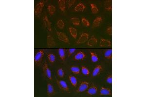 Immunofluorescence analysis of U2OS cells using SLC25 Rabbit pAb (ABIN1682768, ABIN3017839, ABIN3017840 and ABIN6220286) at dilution of 1:100 (40x lens).