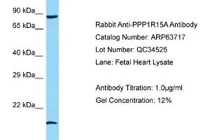 Western Blotting (WB) image for anti-Protein Phosphatase 1, Regulatory (Inhibitor) Subunit 15A (PPP1R15A) (N-Term) antibody (ABIN971447) (GADD34 抗体  (N-Term))