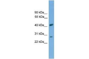 Human THP-1; WB Suggested Anti-SLC25A37 Antibody Titration: 0. (SLC25A37 抗体  (C-Term))
