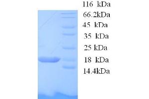 SDS-PAGE (SDS) image for BolA-like Protein 1 (BOLA1) (AA 1-137), (full length) protein (His tag) (ABIN5713286) (BOLA1 Protein (AA 1-137, full length) (His tag))