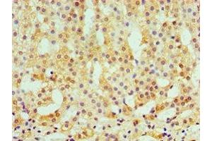 Immunohistochemistry of paraffin-embedded human adrenal gland tissue using ABIN7146438 at dilution of 1:100 (CAMK1G 抗体  (AA 217-476))