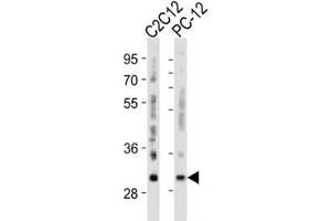Western Blotting (WB) image for anti-B-Cell CLL/lymphoma 2 (BCL2) (AA 75-110) antibody (ABIN3030102)