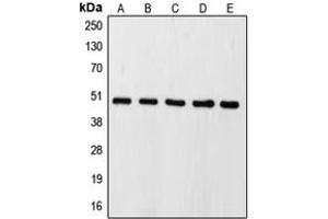 Western blot analysis of Caspase 9 expression in HeLa (A), HEK293T (B), SP2/0 (C), mouse kidney (D), rat lung (E) whole cell lysates. (Caspase 9 抗体  (Center))