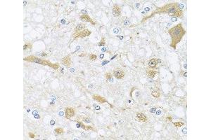 Immunohistochemistry of paraffin-embedded Rat brain using APOL1 Polyclonal Antibody at dilution of 1:100 (40x lens). (APOL1 抗体)