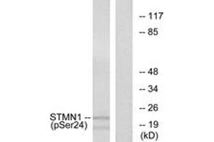 Western blot analysis of extracts from Jurkat cells treated with PMA 1ng/ml 15', using Stathmin 1 (Phospho-Ser24) Antibody. (Stathmin 1 抗体  (pSer25))