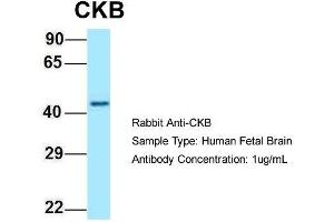 Host: Rabbit  Target Name: CKB  Sample Tissue: Human Fetal Brain  Antibody Dilution: 1. (CKB 抗体  (C-Term))