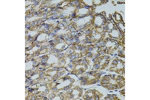 Immunohistochemistry of paraffin-embedded mouse stomach using TRMT2A antibody. (TRMT2A 抗体  (C-Term))