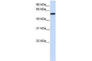 WB Suggested Anti-ZNF675 Antibody Titration: 0. (ZNF675 抗体  (N-Term))