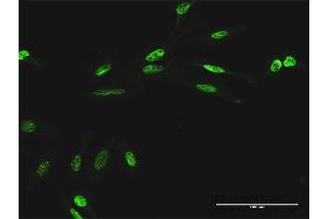 Immunofluorescence of purified MaxPab antibody to RIOK1 on HeLa cell. (RIOK1 抗体  (AA 1-568))