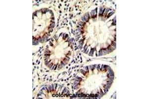 Immunohistochemistry (IHC) image for anti-Thymidylate Synthetase (TYMS) antibody (ABIN3002747) (TYMS 抗体)