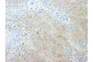 Immunohistochemistry (IHC) image for anti-Protein Tyrosine Phosphatase G1 (PTPN12) (AA 760-780) antibody (ABIN7449005)