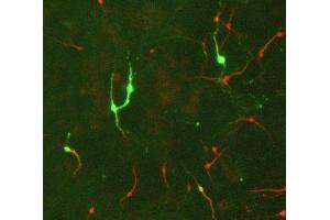 Immunostaining of E17 rat midbrain mixed neuronal cultures showing TH positive neurons in green and MAP2 (ABIN361345) in red. (Tyrosine Hydroxylase 抗体)